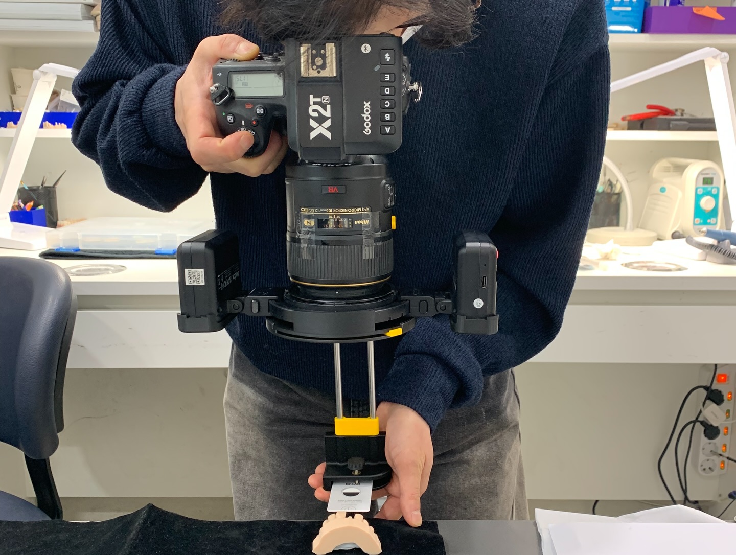 Shade Matching Case 05